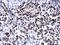 SWI/SNF Related, Matrix Associated, Actin Dependent Regulator Of Chromatin, Subfamily A, Member 4 antibody, GTX633391, GeneTex, Immunohistochemistry paraffin image 