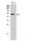 Estrogen Receptor 2 antibody, LS-C383433, Lifespan Biosciences, Western Blot image 