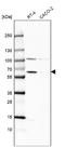 Catalase antibody, NBP2-38646, Novus Biologicals, Western Blot image 