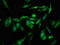 G1 To S Phase Transition 1 antibody, LS-C673286, Lifespan Biosciences, Immunofluorescence image 