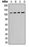 Phosphatidylinositol-4,5-Bisphosphate 3-Kinase Catalytic Subunit Delta antibody, GTX55163, GeneTex, Western Blot image 