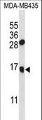 Granulysin antibody, LS-C166565, Lifespan Biosciences, Western Blot image 