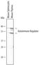 Autoimmune regulator antibody, MA5-24276, Invitrogen Antibodies, Western Blot image 