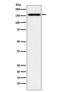 Desmoglein 2 antibody, M02035, Boster Biological Technology, Western Blot image 