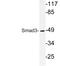 SMAD Family Member 3 antibody, LS-C176639, Lifespan Biosciences, Western Blot image 