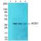 SUMO1 Activating Enzyme Subunit 1 antibody, A04753-2, Boster Biological Technology, Western Blot image 