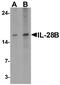 Interferon Lambda 3 antibody, A02261, Boster Biological Technology, Western Blot image 