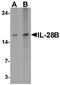 Interleukin-28B antibody, A02261, Boster Biological Technology, Western Blot image 