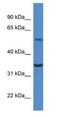 Cytochrome b5 reductase 4 antibody, NBP1-74118, Novus Biologicals, Western Blot image 