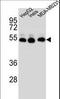 Tubulin Beta 2B Class IIb antibody, LS-C160331, Lifespan Biosciences, Western Blot image 