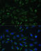 Cytochrome c-type heme lyase antibody, 22-979, ProSci, Immunofluorescence image 