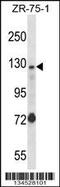 Ubiquitination Factor E4A antibody, 57-907, ProSci, Western Blot image 
