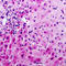 Serpin Family A Member 5 antibody, LS-C353655, Lifespan Biosciences, Immunohistochemistry paraffin image 