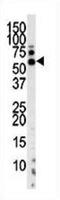 Serine/threonine-protein kinase PINK1, mitochondrial antibody, abx032822, Abbexa, Immunohistochemistry paraffin image 