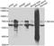 Zinc Finger Protein 264 antibody, A15180, Boster Biological Technology, Western Blot image 