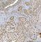 Regulator Of Chromosome Condensation 1 antibody, M02719-1, Boster Biological Technology, Immunohistochemistry paraffin image 