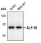 Lymphocyte Cytosolic Protein 2 antibody, PA5-17556, Invitrogen Antibodies, Western Blot image 