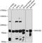 Endoplasmic reticulum mannosyl-oligosaccharide 1,2-alpha-mannosidase antibody, 15-201, ProSci, Western Blot image 