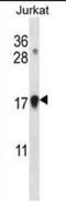 p21 antibody, MBS6001177, MyBioSource, Western Blot image 