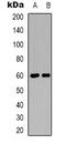 Catalase antibody, orb339092, Biorbyt, Western Blot image 