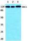 Origin Recognition Complex Subunit 1 antibody, A02735-1, Boster Biological Technology, Western Blot image 
