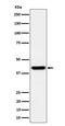 Spermine Synthase antibody, M01831-1, Boster Biological Technology, Western Blot image 