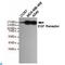 EGFR antibody, LS-C812957, Lifespan Biosciences, Western Blot image 