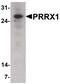 Paired Related Homeobox 1 antibody, PA5-38008, Invitrogen Antibodies, Western Blot image 