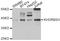 KH domain-containing, RNA-binding, signal transduction-associated protein 3 antibody, A6637, ABclonal Technology, Western Blot image 