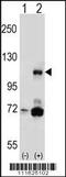 Phosphatidylinositol-4,5-Bisphosphate 3-Kinase Catalytic Subunit Beta antibody, 63-345, ProSci, Western Blot image 