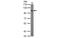 Actinin Alpha 4 antibody, MBS835360, MyBioSource, Western Blot image 