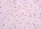 POZ/BTB And AT Hook Containing Zinc Finger 1 antibody, orb100111, Biorbyt, Immunohistochemistry paraffin image 