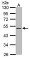 Phosphatidylinositol-5-Phosphate 4-Kinase Type 2 Alpha antibody, PA5-31141, Invitrogen Antibodies, Western Blot image 