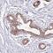 Sorting Nexin 1 antibody, HPA047373, Atlas Antibodies, Immunohistochemistry paraffin image 