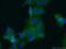 SRC Proto-Oncogene, Non-Receptor Tyrosine Kinase antibody, 60315-1-Ig, Proteintech Group, Immunofluorescence image 
