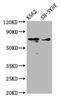 Arachidonate 12-Lipoxygenase, 12S Type antibody, CSB-PA001617LA01HU, Cusabio, Western Blot image 