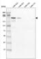 Laminin Subunit Beta 2 antibody, NBP2-42386, Novus Biologicals, Western Blot image 