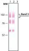 Solute Carrier Family 4 Member 1 (Diego Blood Group) antibody, NB120-11012, Novus Biologicals, Western Blot image 