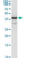 N-Acetylglucosamine Kinase antibody, LS-C139258, Lifespan Biosciences, Western Blot image 