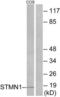 Stathmin 1 antibody, LS-B12436, Lifespan Biosciences, Western Blot image 