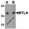 B And T Lymphocyte Associated antibody, 7473, ProSci, Western Blot image 