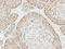 Voltage Dependent Anion Channel 1 antibody, LS-C186351, Lifespan Biosciences, Immunohistochemistry paraffin image 