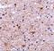 Transmembrane P24 Trafficking Protein 10 antibody, A07234, Boster Biological Technology, Immunohistochemistry paraffin image 