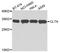 Clathrin Light Chain A antibody, A3793, ABclonal Technology, Western Blot image 