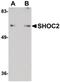 SHOC2 Leucine Rich Repeat Scaffold Protein antibody, PA5-20762, Invitrogen Antibodies, Western Blot image 