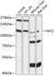 MCC Regulator Of WNT Signaling Pathway antibody, 15-234, ProSci, Western Blot image 
