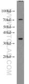 Homeobox A11 antibody, 55495-1-AP, Proteintech Group, Western Blot image 