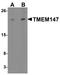 Transmembrane Protein 147 antibody, A15293, Boster Biological Technology, Western Blot image 