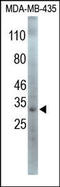 Snail Family Transcriptional Repressor 1 antibody, 200126, Abbiotec, Western Blot image 