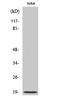 Cofilin 1 antibody, STJ92371, St John